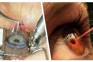 Ophthalmology in Kerala, Ophthalmology in India